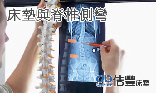 床墊與脊椎側彎